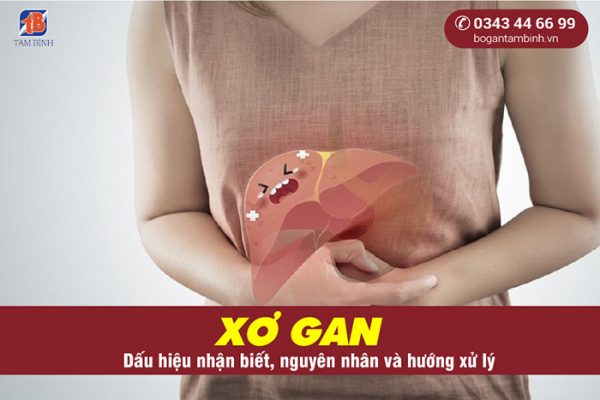 Xơ gan