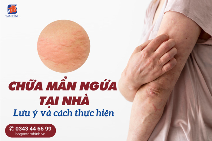 chữa mẩn ngứa tại nhà